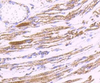 Immunohistochemistry-Paraffin: PDK2 Antibody (JB66-93) [NBP2-75611] - Analysis of paraffin-embedded human fetal skeletal muscle tissue using anti-PDK2 antibody. Counter stained with hematoxylin.