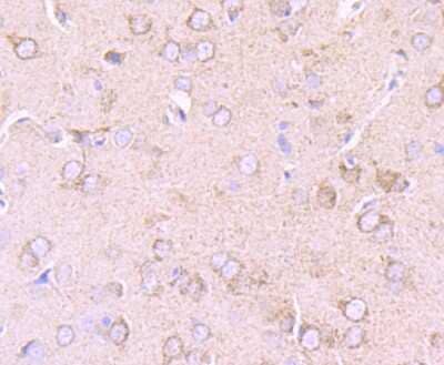 Immunohistochemistry-Paraffin: PDK2 Antibody (JB66-93) [NBP2-75611] - Analysis of paraffin-embedded rat brain tissue using anti-PDK2 antibody. Counter stained with hematoxylin.