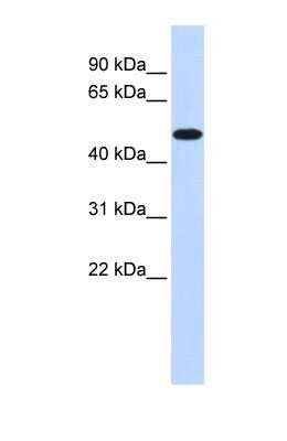 Western Blot: PDK2 Antibody [NBP1-54699] - 293T cell lysate, Antibody Titration: 0.2-1 ug/ml.