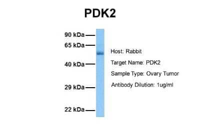 Western Blot: PDK2 Antibody [NBP1-54699] - Sample Tissue: Human Ovary Tumor Antibody Dilution: 1.0 ug/ml
