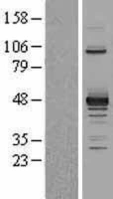 Western Blot: PDK2 Overexpression Lysate (Adult Normal) [NBL1-14250] Left-Empty vector transfected control cell lysate (HEK293 cell lysate); Right -Over-expression Lysate for PDK2.