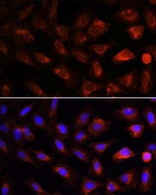 Immunocytochemistry/Immunofluorescence: PDK4 Antibody [NBP2-93829] - Immunofluorescence analysis of U-2 OS cells using PDK4 antibody (NBP2-93829) at dilution of 1:100. Blue: DAPI for nuclear staining.