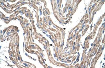 Immunohistochemistry-Paraffin: PDK4 Antibody [NBP1-54723] - Human Muscle Tissue, Skeletal muscle cells (Indicated with Arrows) 4-8ug/ml.