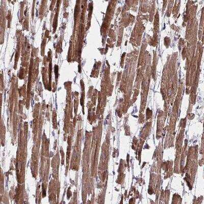 Immunohistochemistry-Paraffin: PDK4 Antibody [NBP2-49235] - Staining of human heart muscle shows strong cytoplasmic positivity in myocytes.