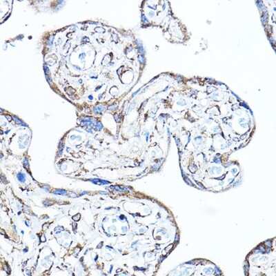 Immunohistochemistry-Paraffin: PDK4 Antibody [NBP2-93829] - Human placenta using PDK4 Rabbit pAb (NBP2-93829) at dilution of 1:100 (40x lens). Perform high pressure antigen retrieval with 10 mM citrate buffer pH 6.0 before commencing with IHC staining protocol.