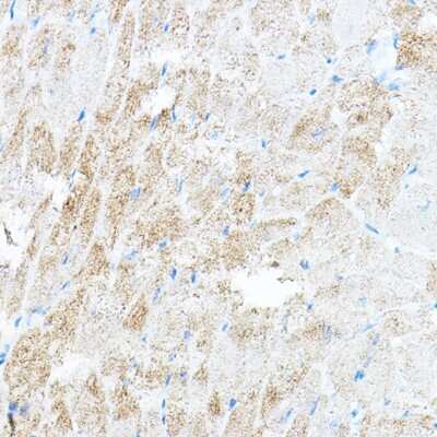 Immunohistochemistry-Paraffin: PDK4 Antibody [NBP2-93829] - Mouse heart using PDK4 Rabbit pAb (NBP2-93829) at dilution of 1:100 (40x lens). Perform high pressure antigen retrieval with 10 mM citrate buffer pH 6.0 before commencing with IHC staining protocol.