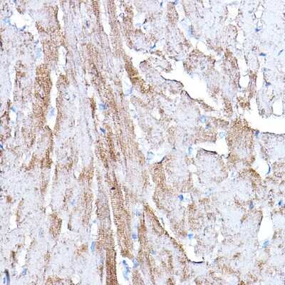 Immunohistochemistry-Paraffin: PDK4 Antibody [NBP2-95194] - Immunohistochemistry of paraffin-embedded rat heart using PDK4 Rabbit pAb (NBP2-95194) at dilution of 1:100 (40x lens). Perform high pressure antigen retrieval with 10 mM citrate buffer pH 6.0 before commencing with IHC staining protocol.