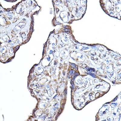 Immunohistochemistry-Paraffin: PDK4 Antibody [NBP2-95194] - Immunohistochemistry of paraffin-embedded human placenta using PDK4 Rabbit pAb (NBP2-95194) at dilution of 1:100 (40x lens). Perform high pressure antigen retrieval with 10 mM citrate buffer pH 6.0 before commencing with IHC staining protocol.