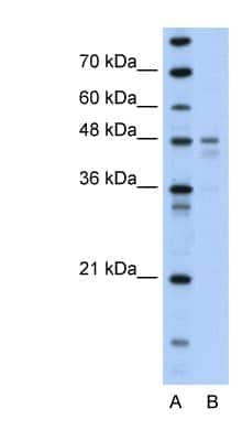 Western Blot: PDK4 Antibody [NBP1-54723] - Titration: 0.2-1 ug/ml Positive Control: Transfected 293T.