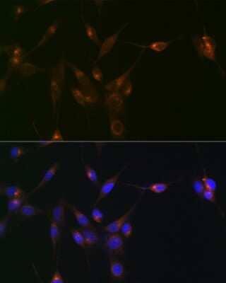 Immunocytochemistry/Immunofluorescence: PDLIM1 Antibody (5X10L2) [NBP3-15689] - Immunofluorescence analysis of NIH/3T3 cells using PDLIM1 Rabbit mAb (NBP3-15689) at dilution of 1:100 (40x lens). Blue: DAPI for nuclear staining.