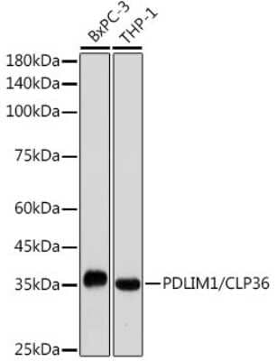 Western Blot: PDLIM1 Antibody (5X10L2) [NBP3-15689] - Western blot analysis of extracts of various cell lines, using PDLIM1 antibody (NBP3-15689) at 1:1000 dilution. Secondary antibody: HRP Goat Anti-Rabbit IgG (H+L) at 1:10000 dilution. Lysates/proteins: 25ug per lane. Blocking buffer: 3% nonfat dry milk in TBST. Detection: ECL Basic Kit. Exposure time: 10s.