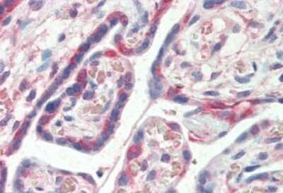 Immunohistochemistry-Paraffin: PDLIM1 Antibody [NBP1-51917] - (5ug/ml) staining of paraffin embedded Human Placenta. Steamed antigen retrieval with citrate buffer pH 6, AP-staining.