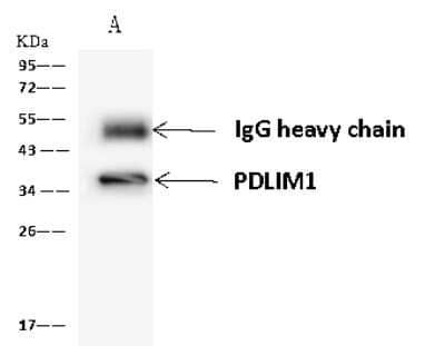 Immunoprecipitation: PDLIM1 Antibody [NBP2-98546] - PDLIM1 was immunoprecipitated using: Lane A: 0.5 mg 293T Whole Cell Lysate 4 ul anti-PDLIM1 rabbit polyclonal antibody and 60 ug of Immunomagnetic beads Protein A/G.  Primary antibody: Anti-PDLIM1 rabbit polyclonal antibody, at 1:100 dilution. Secondary antibody: Goat Anti-Rabbit IgG (H+L)/HRP at 1/10000 dilution. Developed using the ECL technique. Performed under reducing conditions. Predicted band size: 36 kDa. Observed band size: 36 kDa