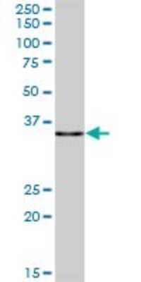 Western Blot: PDLIM1 Antibody [H00009124-B01P] - Analysis of PDLIM1 expression in human placenta.
