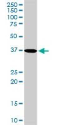 Western Blot: PDLIM1 Antibody [H00009124-D01P] - Analysis of PDLIM1 expression in human liver.