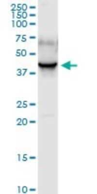 Western Blot: PDLIM1 Antibody [H00009124-D01P] - Analysis of PDLIM1 expression in human pancreas.