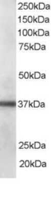 Western Blot: PDLIM1 Antibody [NBP1-51917] - (0.1ug/ml) of Human Lung lysate (RIPA buffer, 35ug total protein per lane).  Primary incubated for 1 hour.  Detected by chemiluminescence.