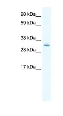 Western Blot: PDLIM1 Antibody [NBP1-80239] - Titration: 0.625ug/ml, Positive Control: NIH/3T3 cell lysate.