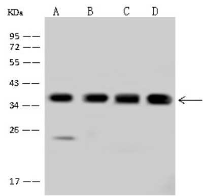 Western Blot: PDLIM1 Antibody [NBP2-98546] - Anti-PDLIM1 rabbit polyclonal antibody at 1:500 dilution. Lane A: Jurkat Whole Cell Lysate Lane B: HeLa Whole Cell Lysate Lane C: 293T Whole Cell Lysate Lane D: Caco-2 Whole Cell Lysate Lysates/proteins at 30 ug per lane. Secondary Goat Anti-Rabbit IgG (H+L)/HRP at 1/10000 dilution. Developed using the ECL technique. Performed under reducing conditions. Predicted band size: 36 kDa. Observed band size: 36 kDa