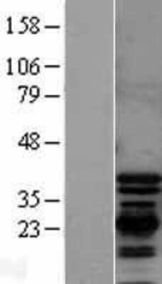 Western Blot: PDLIM1 Overexpression Lysate (Adult Normal) [NBL1-14253] Left-Empty vector transfected control cell lysate (HEK293 cell lysate); Right -Over-expression Lysate for PDLIM1.