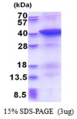 SDS-Page: PDLIM1 Recombinant Protein [NBP2-51543] - 15% SDS Page (3 ug)