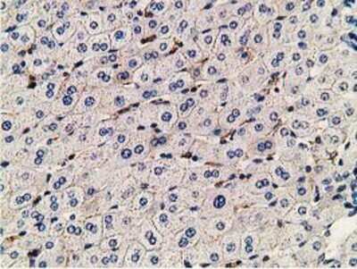 Immunohistochemistry-Paraffin: PDLIM2 Antibody (11A12) [NBP2-00619] - Staining of paraffin-embedded Human liver tissue using anti-PDLIM2 mouse monoclonal antibody.