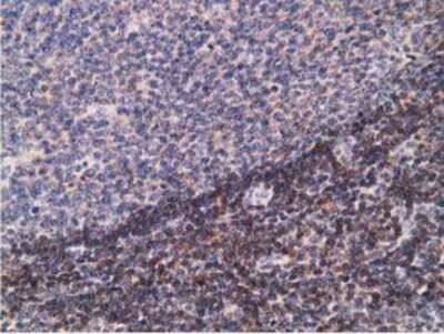 Immunohistochemistry-Paraffin: PDLIM2 Antibody (11A12) [NBP2-00619] - Staining of paraffin-embedded Human lymph node tissue using anti-PDLIM2 mouse monoclonal antibody.