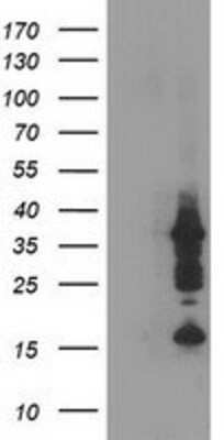 Western Blot: PDLIM2 Antibody (11A12) [NBP2-00619] - HEK293T cells were transfected with the pCMV6-ENTRY control (Left lane) or pCMV6-ENTRY PDLIM2 (Right lane) cDNA for 48 hrs and lysed. Equivalent amounts of cell lysates (5 ug per lane) were separated by SDS-PAGE and immunoblotted with anti-PDLIM2.