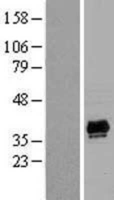 Western Blot: PDLIM2 Overexpression Lysate (Adult Normal) [NBL1-14254] Left-Empty vector transfected control cell lysate (HEK293 cell lysate); Right -Over-expression Lysate for PDLIM2.