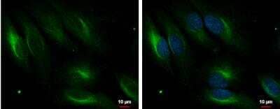 Immunocytochemistry/Immunofluorescence: PDLIM4 Antibody [NBP2-19759] - HeLa cells were fixed in 4% paraformaldehyde at RT for 15 min. Green: PDLIM4 protein stained by PDLIM4 antibody [C2C3], C-term diluted at 1:1000. Blue: Hoechst 33342 staining. Scale bar = 10 um.