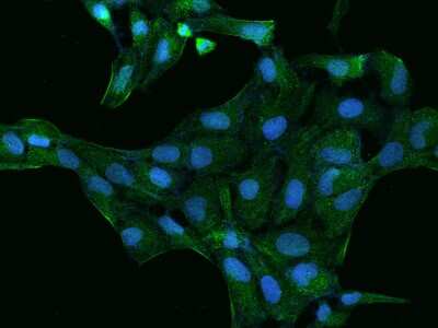 Immunocytochemistry/Immunofluorescence: PDLIM4 Antibody [NBP2-98063] - Immunofluorescence staining of PDLIM4 in U2OS cells. Cells were fixed with 4% PFA, permeabilzed with 0.1% Triton X-100 in PBS, blocked with 10% serum, and incubated with rabbit anti-Human PDLIM4 polyclonal antibody (dilution ratio 1:200) at 4C overnight. Then cells were stained with the Alexa Fluor(R)488-conjugated Goat Anti-rabbit IgG Secondary antibody (green) and counterstained with DAPI (blue).Positive staining was localized to Cytoplasm.