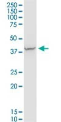 Western Blot: PDLIM4 Antibody [H00008572-B01P] - Analysis of PDLIM4 expression in human spleen.