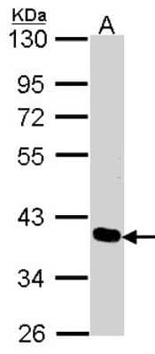 Western Blot: PDLIM4 Antibody [NBP2-19759] - Sample (30 ug of whole cell lysate) A: A431 10% SDS PAGE gel, diluted at 1:1000.