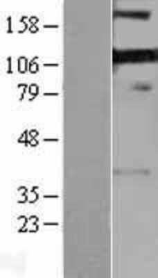 Western Blot: PDLIM4 Overexpression Lysate (Adult Normal) [NBP2-04255] Left-Empty vector transfected control cell lysate (HEK293 cell lysate); Right -Over-expression Lysate for PDLIM4.