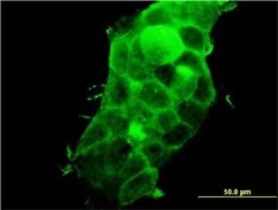 Immunocytochemistry/Immunofluorescence: PDLIM5 Antibody (3E11-F6) [H00010611-M01] - Analysis of monoclonal antibody to PDLIM5 on A-431 cell. Antibody concentration 10 ug/ml.