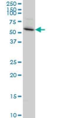 Western Blot: PDLIM5 Antibody (3E11-F6) [H00010611-M01] - Western Blot analysis of PDLIM5 expression in A-431 ( Cat # L015V1 ).