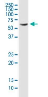 Western Blot: PDLIM5 Antibody (3E11-F6) [H00010611-M01] - PDLIM5 monoclonal antibody (M01), clone 3E11-F6. Analysis of PDLIM5 expression in HepG2.