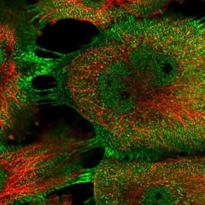 Immunocytochemistry/Immunofluorescence: PDLIM5 Antibody [NBP1-84842] - Immunofluorescent staining of human cell line U-251 MG shows localization to nucleoplasm & plasma membrane.