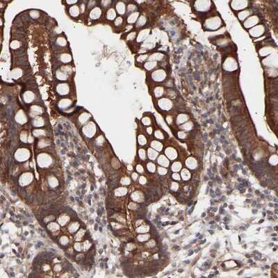 Immunohistochemistry-Paraffin: PDLIM5 Antibody [NBP1-84842] - Staining of human small intestine shows strong cytoplasmic positivity in glandular cells.