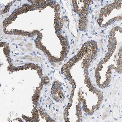 Immunohistochemistry-Paraffin: PDLIM5 Antibody [NBP1-84843] - Staining of human prostate shows moderate cytoplasmic positivity in glandular cells.