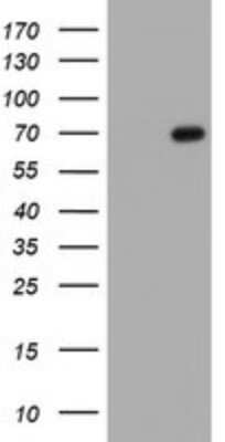 Western Blot: PDLIM5 Antibody (OTI1B5) - Azide and BSA Free [NBP2-73316] - Analysis of HEK293T cells were transfected with the pCMV6-ENTRY control (Left lane) or pCMV6-ENTRY PDLIM5.