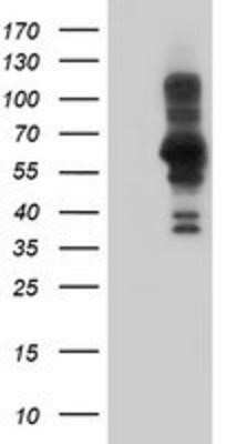 Western Blot: PDLIM5 Antibody (OTI1H10) - Azide and BSA Free [NBP2-73317] - HEK293T cells were transfected with the pCMV6-ENTRY control (Left lane) or pCMV6-ENTRY PDLIM5 (Right lane) cDNA for 48 hrs and lysed. Equivalent amounts of cell lysates (5 ug per lane) were separated by SDS-PAGE and immunoblotted with anti-PDLIM5.