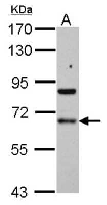 Western Blot: PDLIM5 Antibody [NBP2-19760] - Sample (30 ug of whole cell lysate) A: HeLa 7. 5% SDS PAGE gel, diluted at 1:1000.