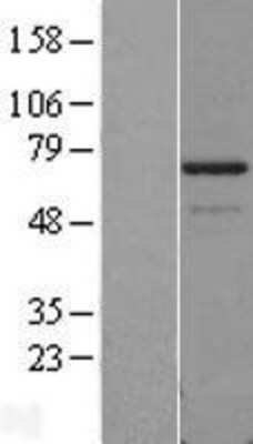 Western Blot: PDLIM5 Overexpression Lysate (Adult Normal) [NBL1-14257] Left-Empty vector transfected control cell lysate (HEK293 cell lysate); Right -Over-expression Lysate for PDLIM5.