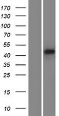 Western Blot: PDLIM7 Overexpression Lysate (Adult Normal) [NBP2-04555] Left-Empty vector transfected control cell lysate (HEK293 cell lysate); Right -Over-expression Lysate for PDLIM7.