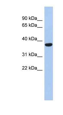 Western Blot PDP1/PPAPDC2 Antibody - BSA Free