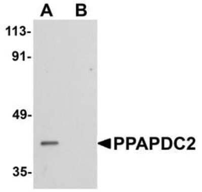 Western Blot PDP1/PPAPDC2 Antibody - BSA Free