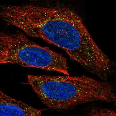 Immunocytochemistry/Immunofluorescence: PDPK1 Antibody [NBP2-56546] - Staining of human cell line U-2 OS shows localization to vesicles.