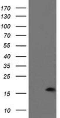 Western Blot: PDRG1 Antibody (OTI4F12) - Azide and BSA Free [NBP2-73320] - HEK293T cells were transfected with the pCMV6-ENTRY control (Left lane) or pCMV6-ENTRY PDRG1 (Right lane) cDNA for 48 hrs and lysed. Equivalent amounts of cell lysates (5 ug per lane) were separated by SDS-PAGE and immunoblotted with anti-PDRG1.