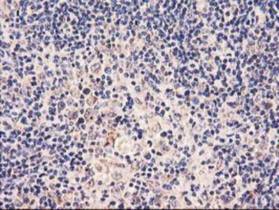 Immunohistochemistry: PDSS2 Antibody (OTI1D12) - Azide and BSA Free [NBP2-73323] - Staining of paraffin-embedded Human lymphoma tissue using anti-PDSS2 mouse monoclonal antibody.